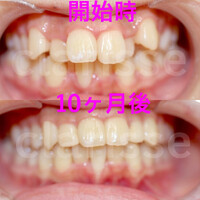 画像266