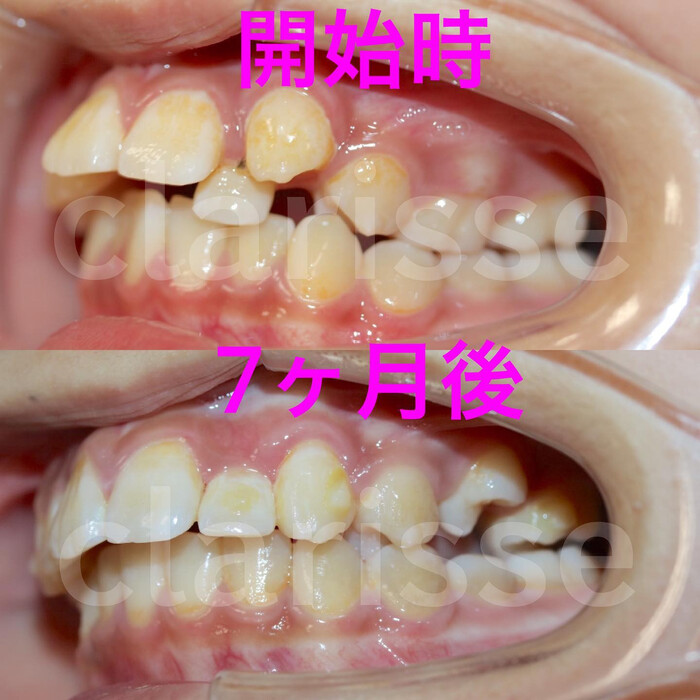 画像292