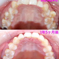 画像302