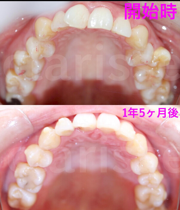 画像302