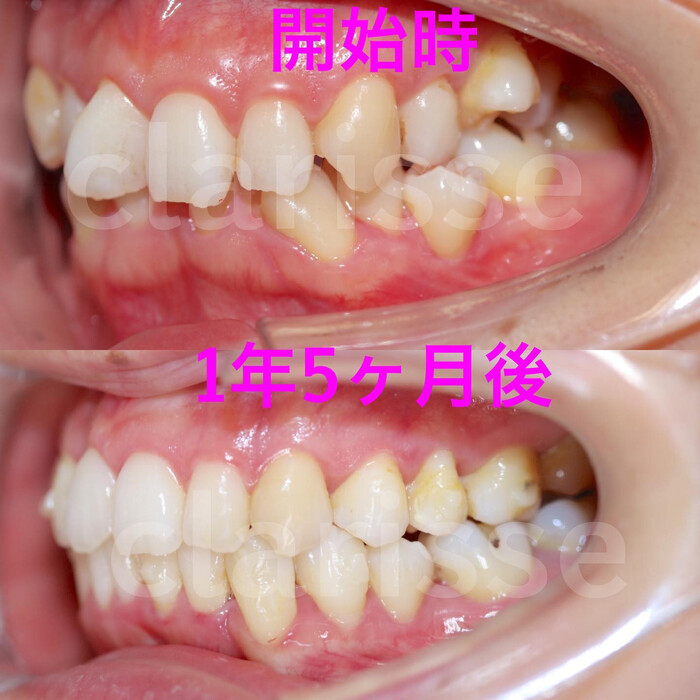 画像306