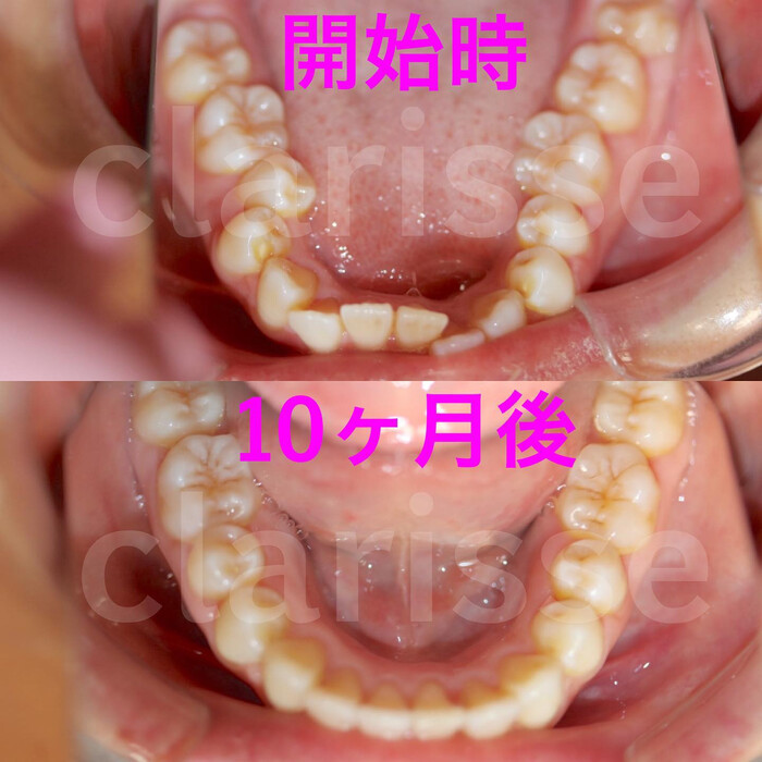 画像310