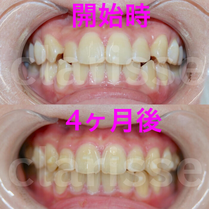 画像320