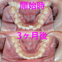 画像322