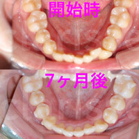 画像324