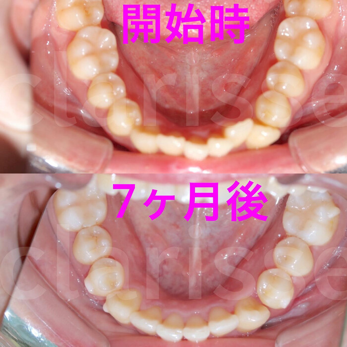 画像324