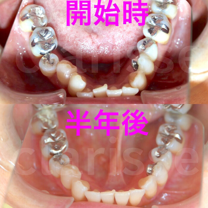画像326