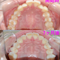 画像330