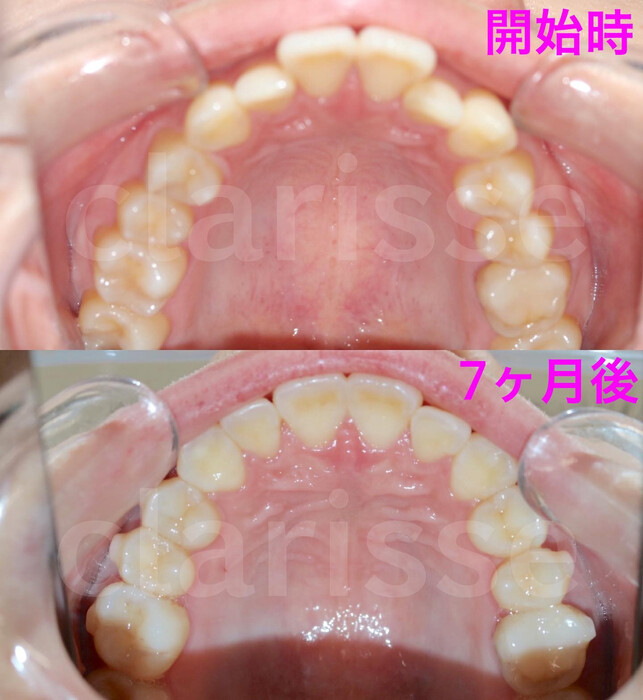 画像330
