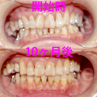 画像334