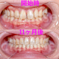画像336