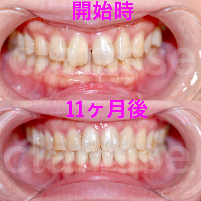 画像336