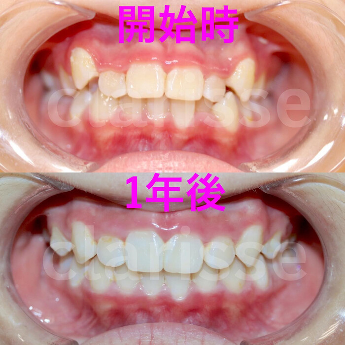 画像338