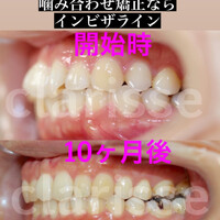 画像360