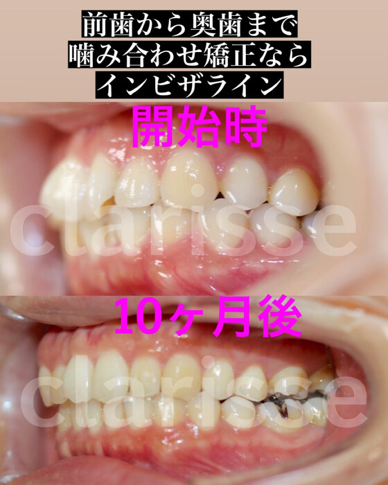 画像360
