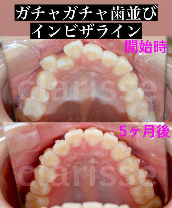 画像366