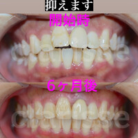 画像376