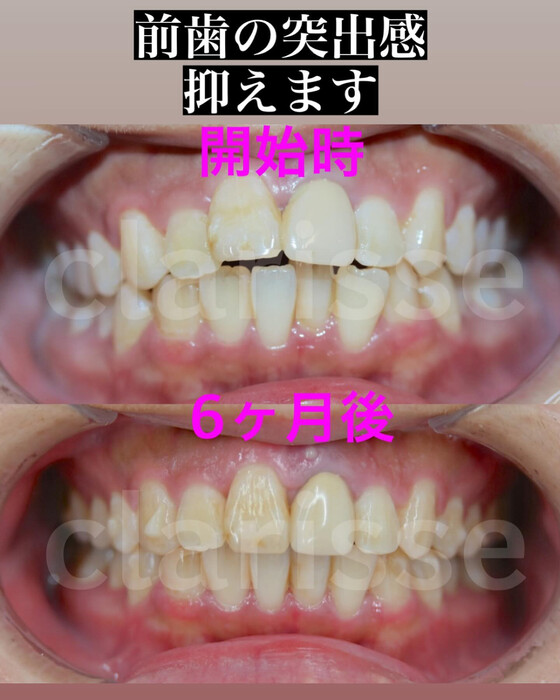 画像376