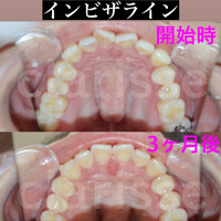 画像378