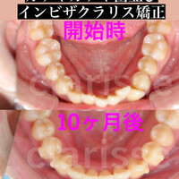 画像398