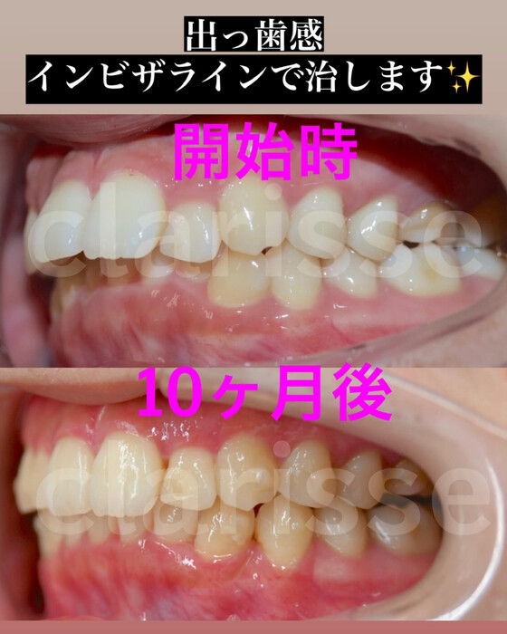 画像400