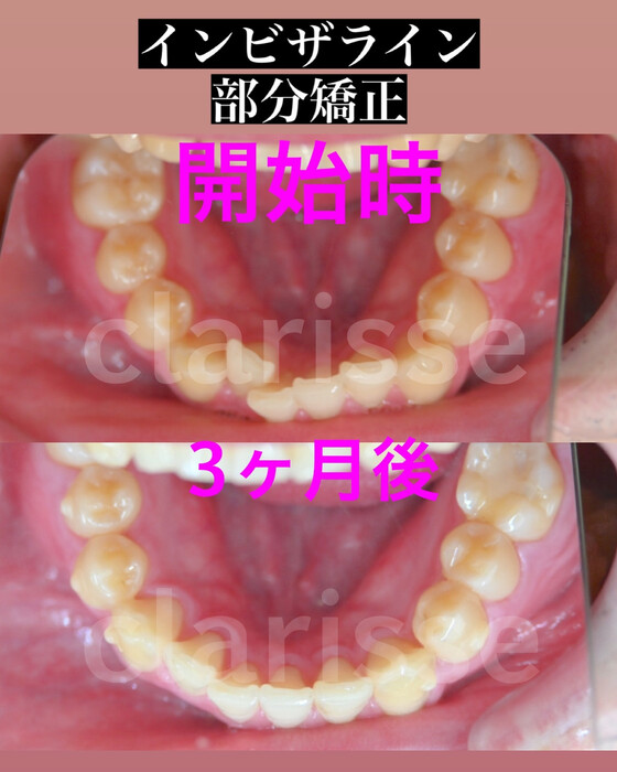 画像404