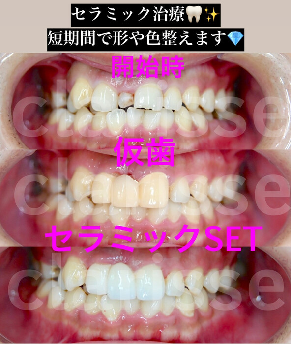 画像410