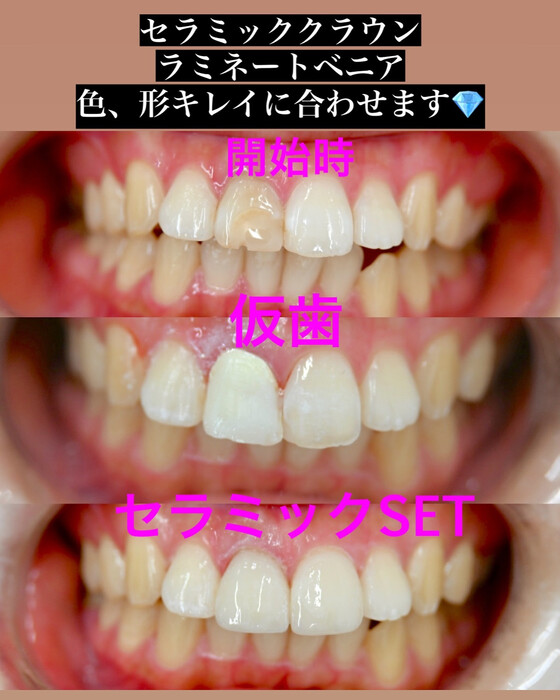 画像412