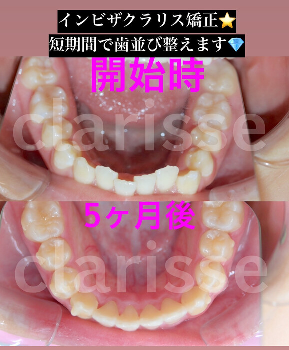 画像414