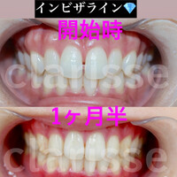 画像424