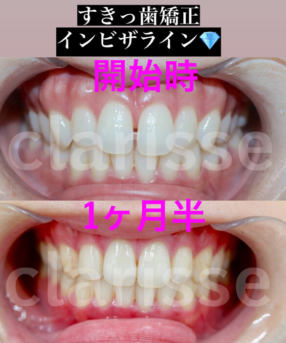 画像424