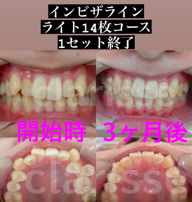 画像428