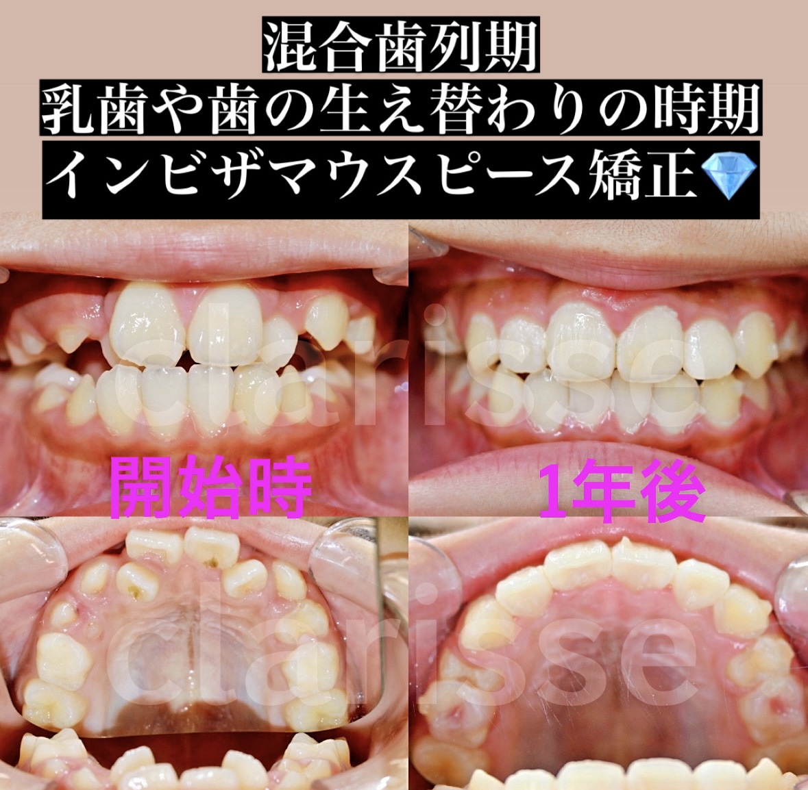症例写真