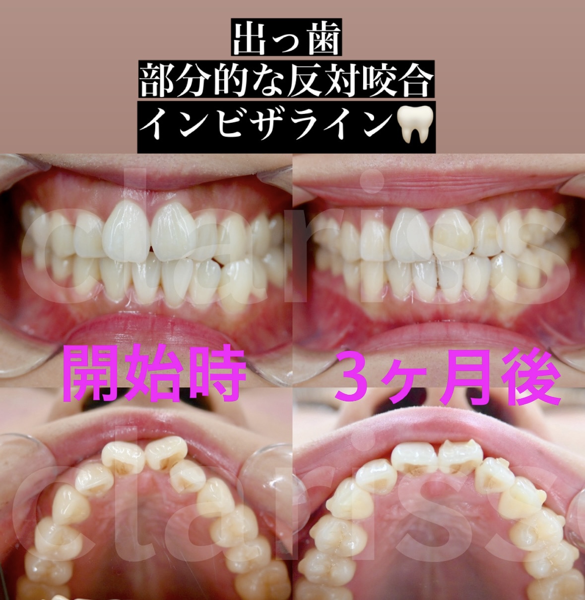 症例写真