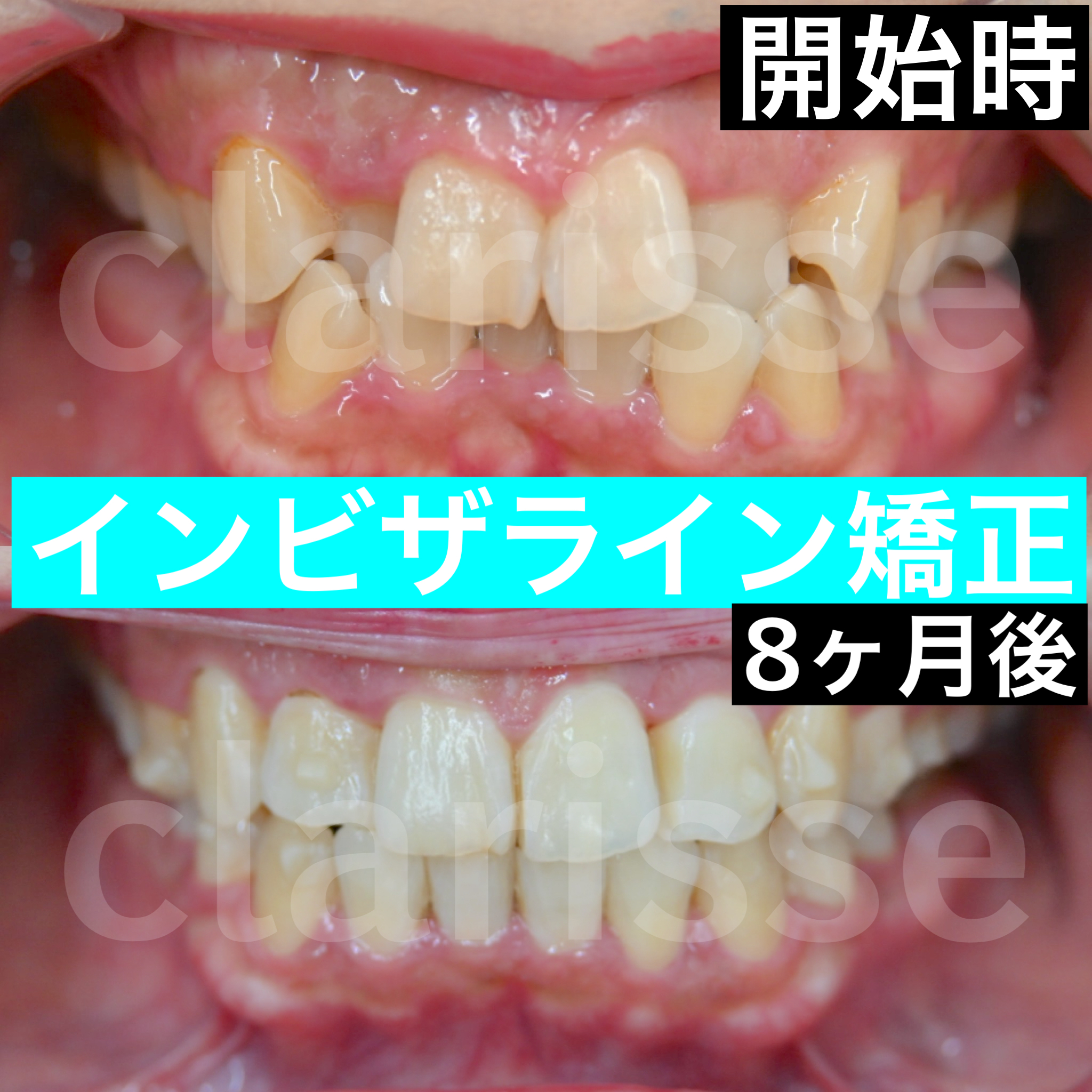 症例写真