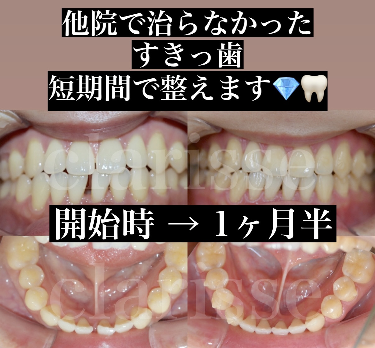 症例写真
