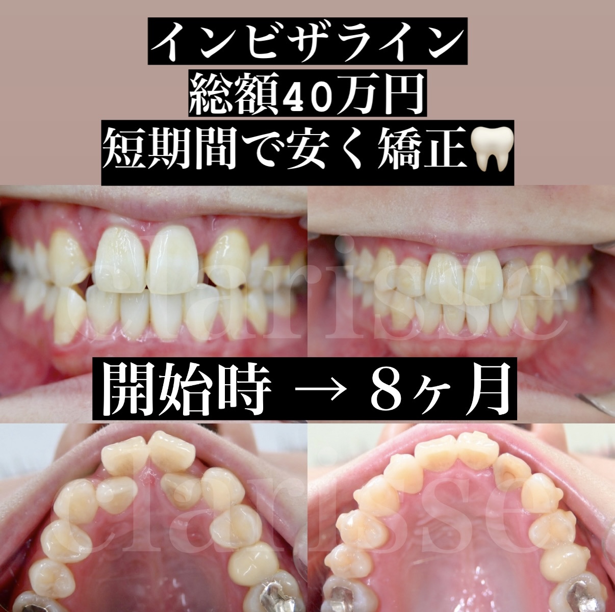 症例写真