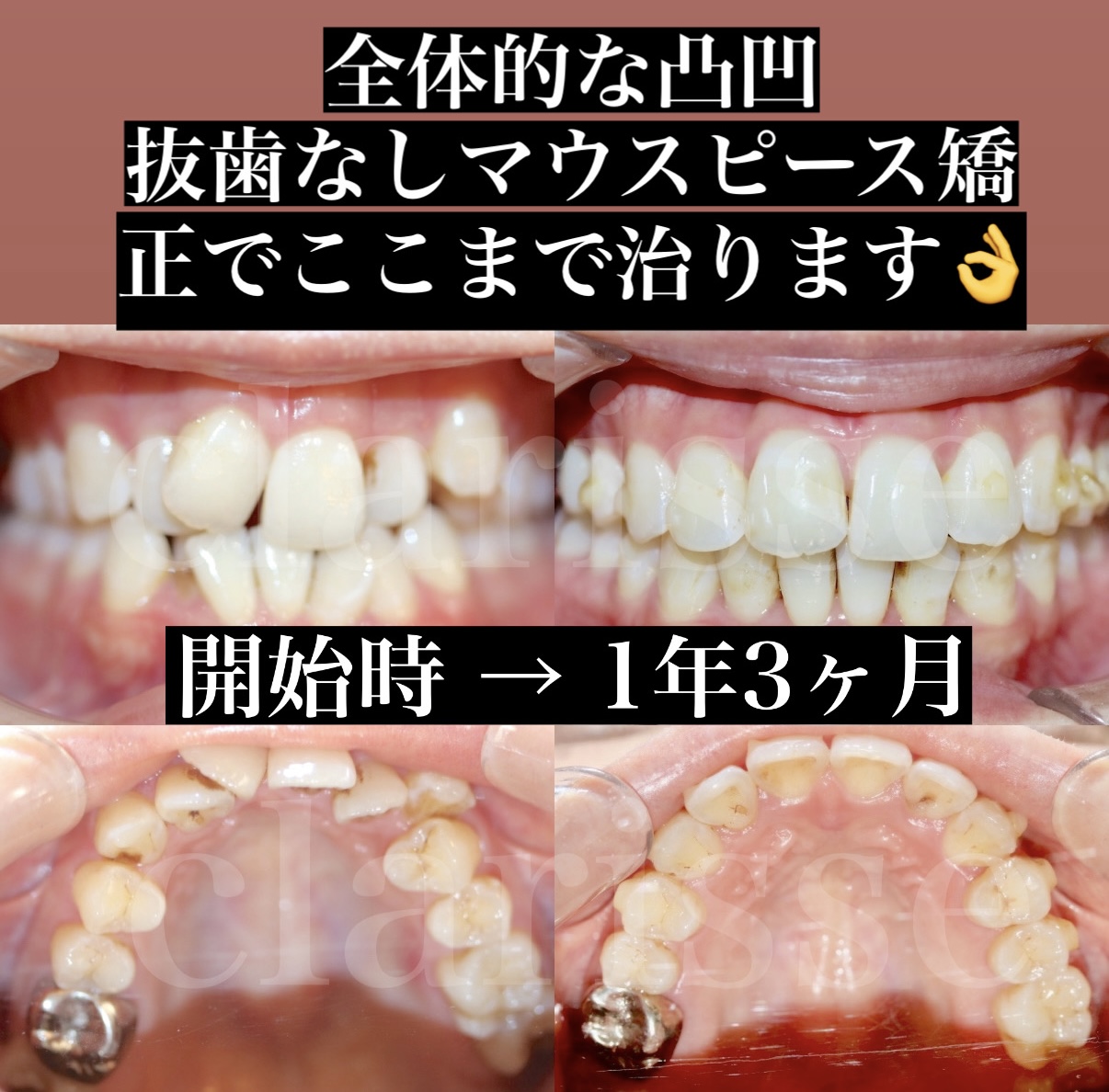 症例写真
